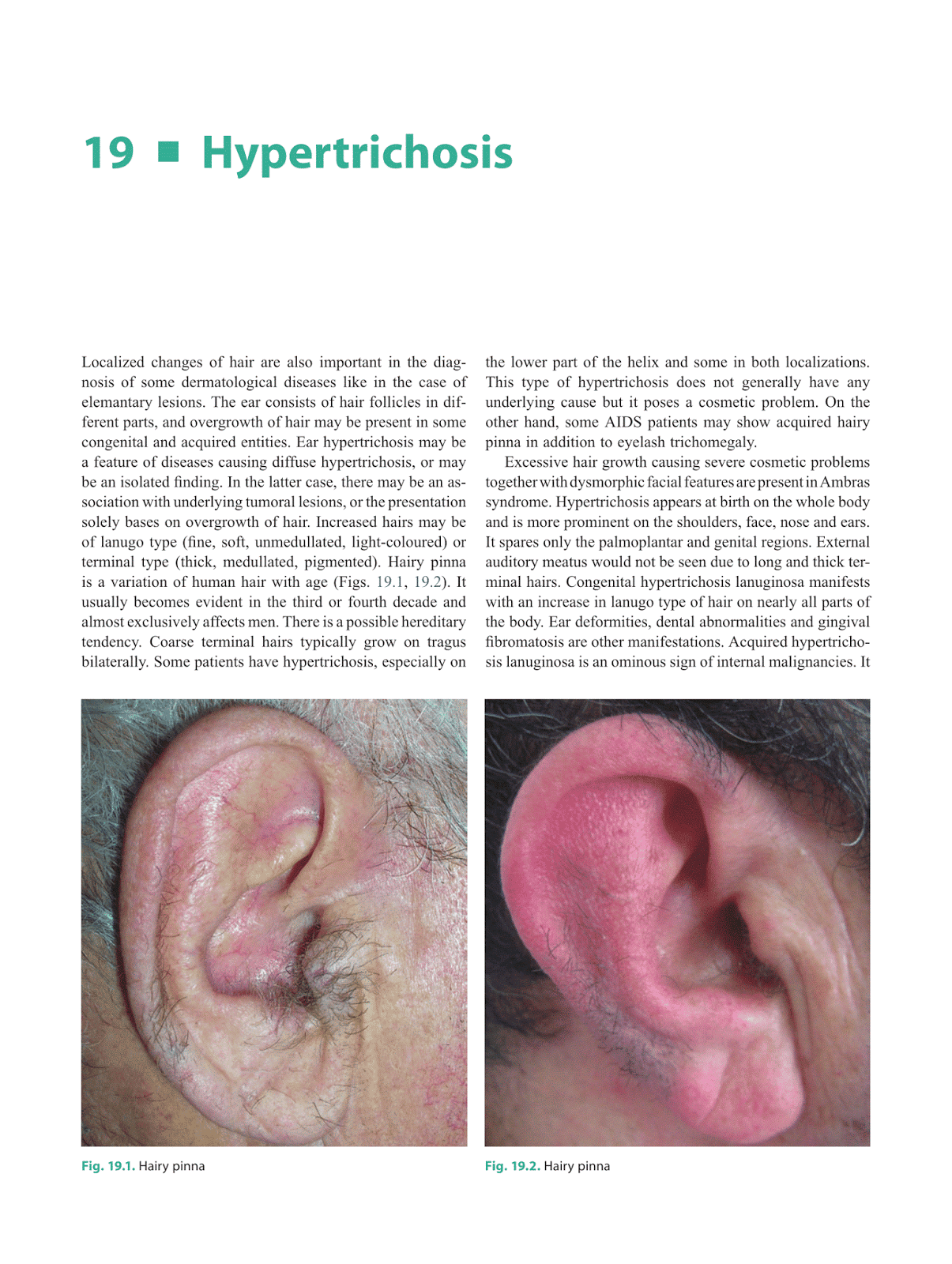 Case Study Method in Psychology | Simply Psychology